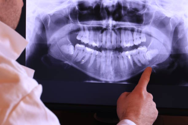 Best Emergency Dental Care for Trauma or Injury in Mapleton, UT